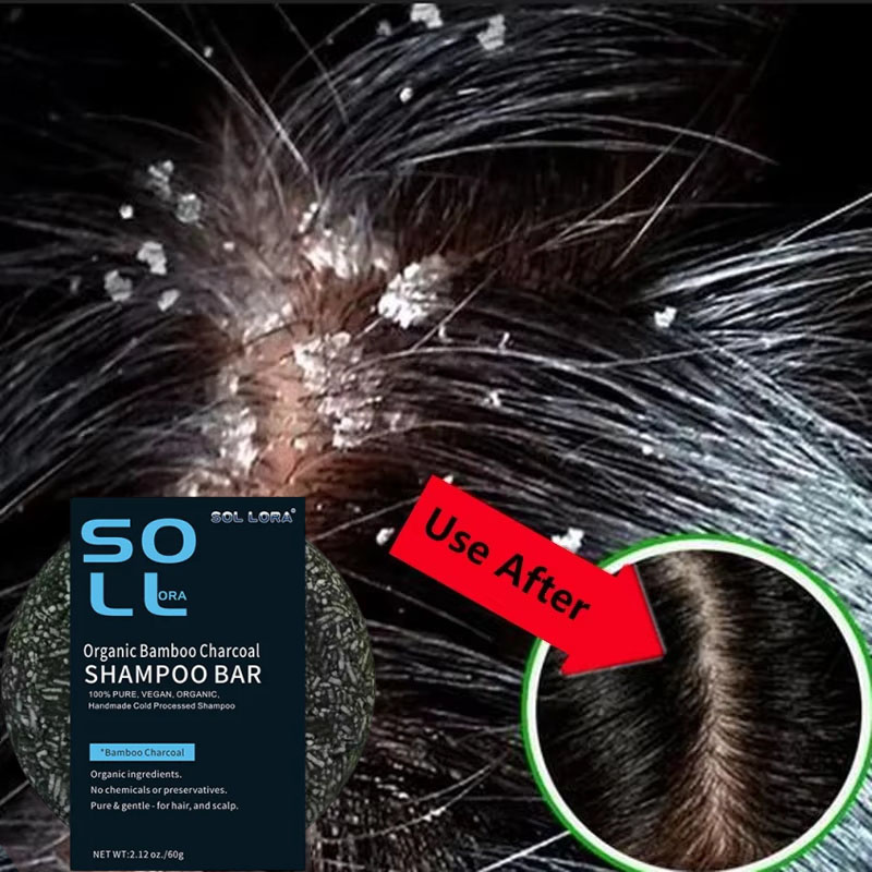 Hair Care Dandruff - Savon de traitement Anti-pelliculaire rapide, réparation