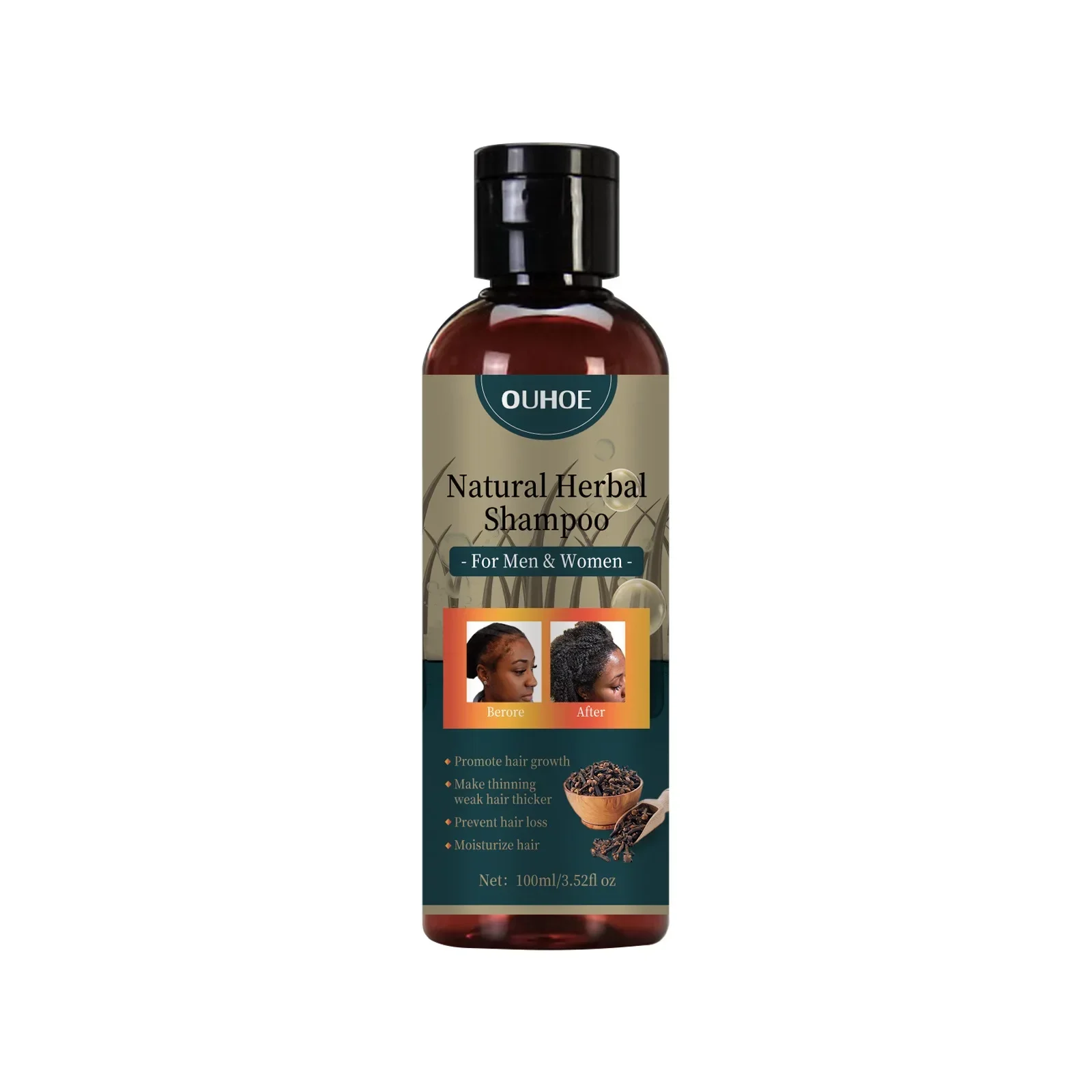 OUHOE Croissance Des Cheveux S - Hair Care Dandruff avis et prix