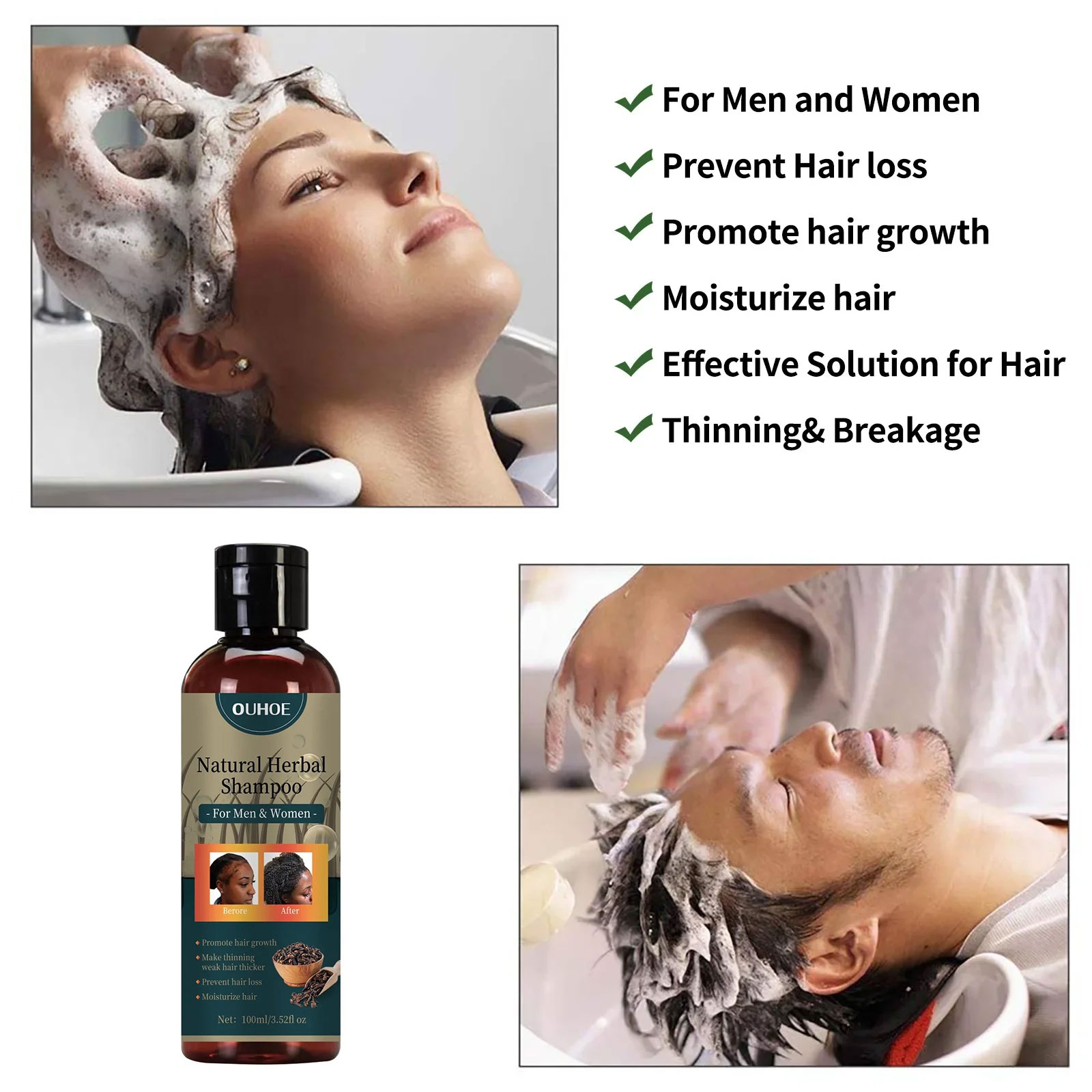 OUHOE Croissance Des Cheveux S - Hair Care Dandruff avis et prix